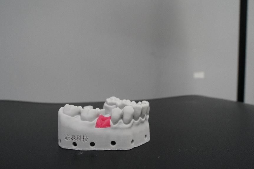 3D打印在牙科的应用